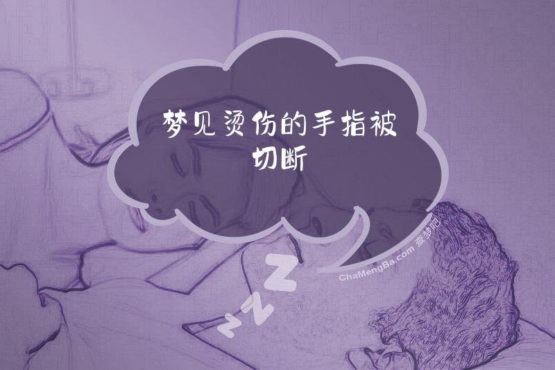 梦见烫伤的手指被切断