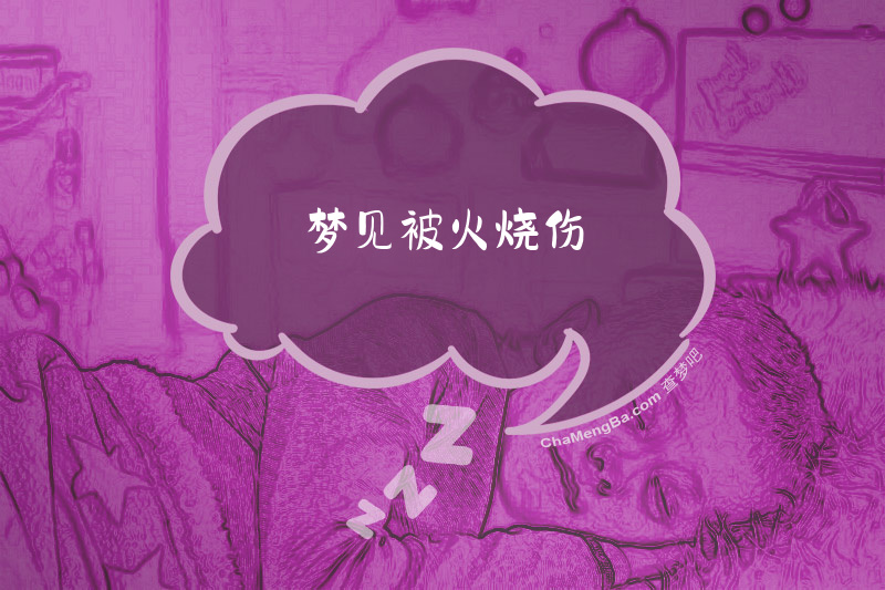 梦见被火烧伤