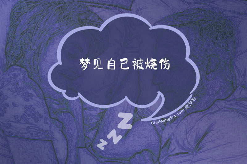 梦见自己被烧伤